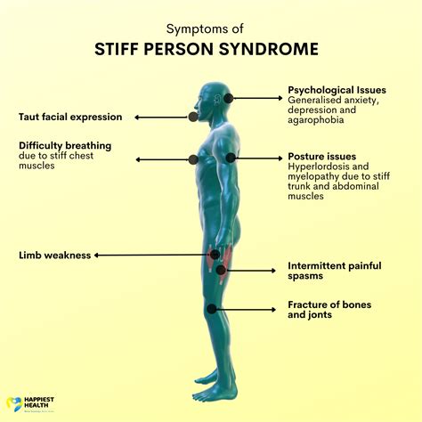 stiff person syndrome celine|stiff person syndrome symptoms nhs.